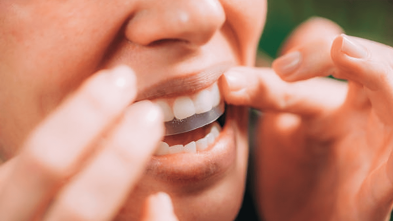 Crest Whitestrips: Everything You Need To Know - Ollie