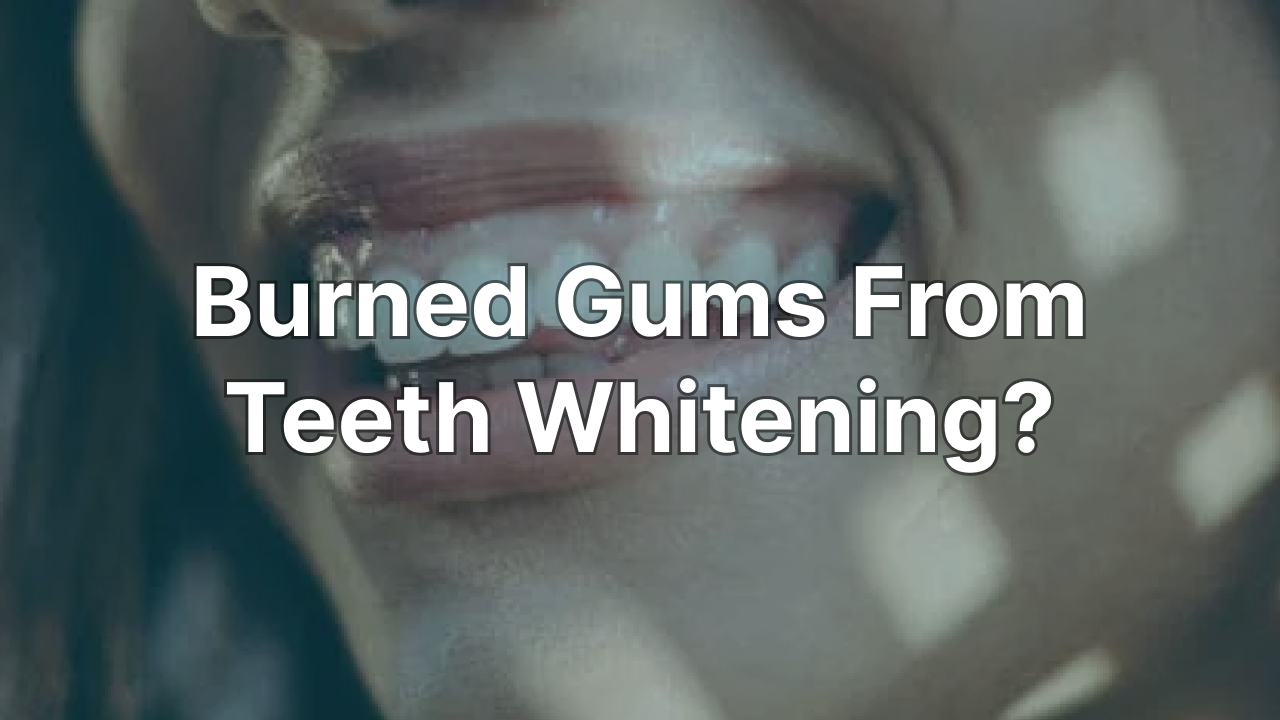 Burned Gums From Teeth Whitening? What You Should Know Ollie