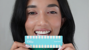 Teeth Whitening: The Complete Guide + Pricing